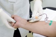 Coletas de sangue no SAE não serão realizadas nessa quarta-feira, dia 23