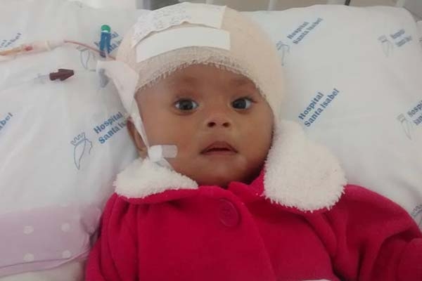 Fam�lia gasparense pede ajuda no  tratamento de crian�a com hidrocefalia