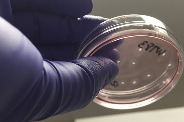 Novo laborat�rio em SP cria 'minic�rebros' para tratamento de autismo. 