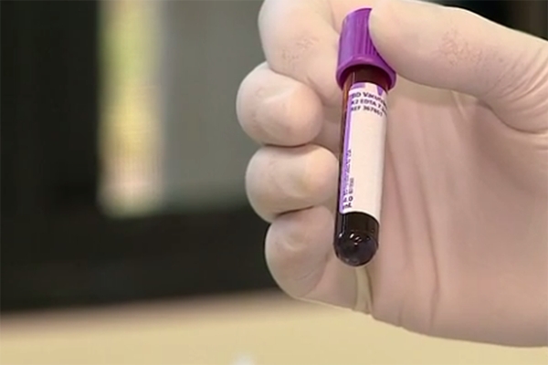 Coleta de sangue para doa��es de medula �ssea est� suspensa em SC