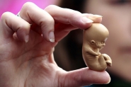 Pases se unem para criar fundo internacional de aborto seguro
