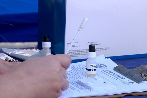 Casos de jovens adultos de 20 a 34 anos com HIV crescem 43% em SC