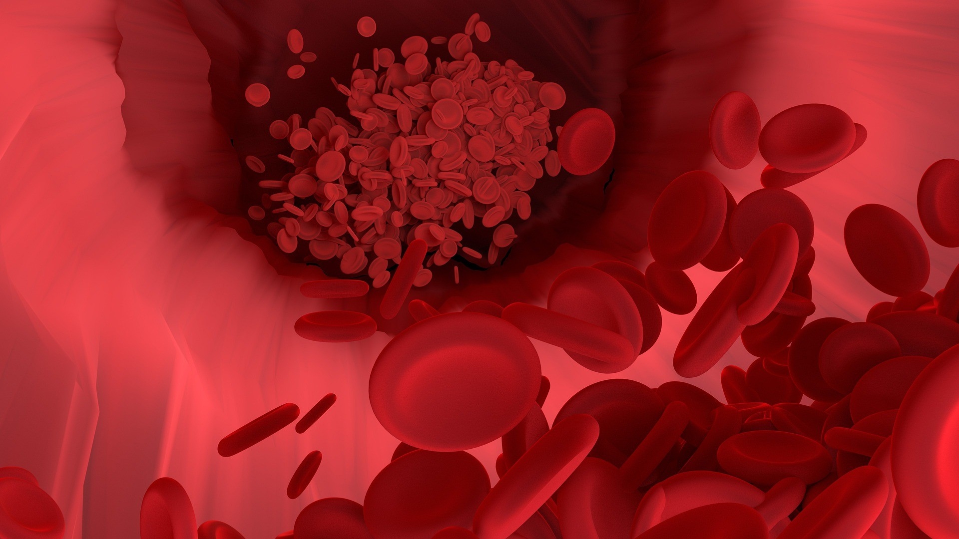 Cientistas modificam clulas sanguneas para torn-las resistentes ao HIV