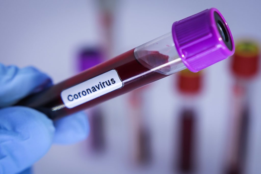 Sobe para cinco o n�mero de casos suspeitos de coronav�rus em Gaspar