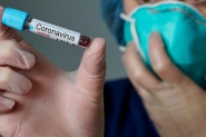 Gasparense testa positivo para coronav�rus ap�s exame em laborat�rio particular