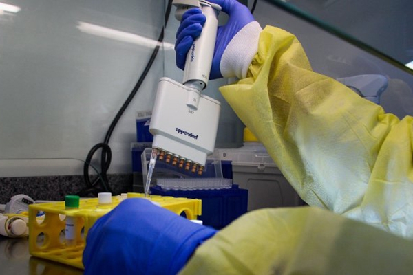 Governo de SC investe em novos kits para testes de Covid-19 por biologia molecular