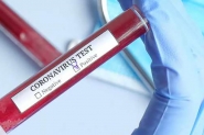 M�dica do posto de sa�de do Santa Terezinha testa positivo para coronav�rus