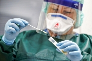 Anvisa aprova testes r�pidos de coronav�rus em farm�cias e drogarias