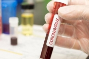 Ilhota registra 12 novos casos de coronav�rus e j� contabiliza 50 infectados