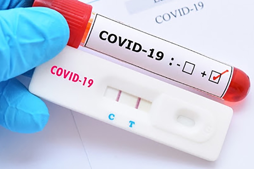 Blumenau passa dos mil casos confirmados de Covid-19