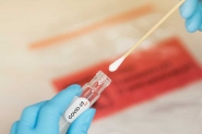 Você sabe como funcionam os testes para Covid-19?