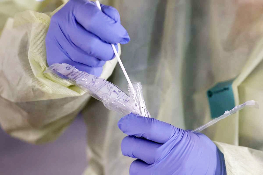 Confirmação de três mortes por Covid-19 marca segunda-feira em Gaspar