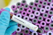 Coronav�rus: Gaspar � a terceira cidade do M�dio Vale com maior n�mero de casos, �bitos e recuperados