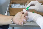 S�bado tem testagem r�pida de coronav�rus no Centro de Triagem em Gaspar