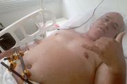 Gasparense v�tima de acidente de tr�nsito pede ajuda para tratamento de sa�de
