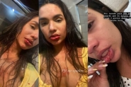 Trancada no banheiro, influencer usa Instagram para pedir ajuda ap�s agress�o em Florian�polis