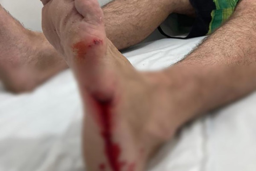 Surfista pode ter sido mordido por tubar�o na praia de Navegantes