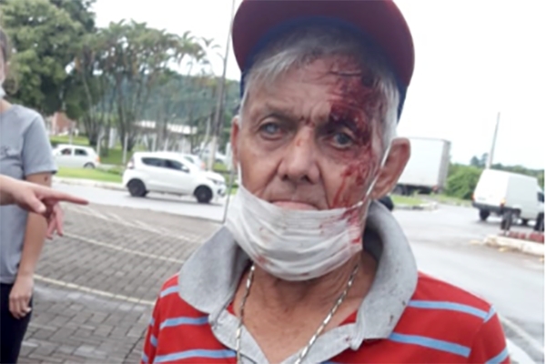 Idoso sofre queda, machuca a cabe�a e central dos bombeiros n�o gera ocorr�ncia