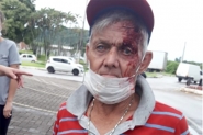 Idoso sofre queda, machuca a cabe�a e central dos bombeiros n�o gera ocorr�ncia