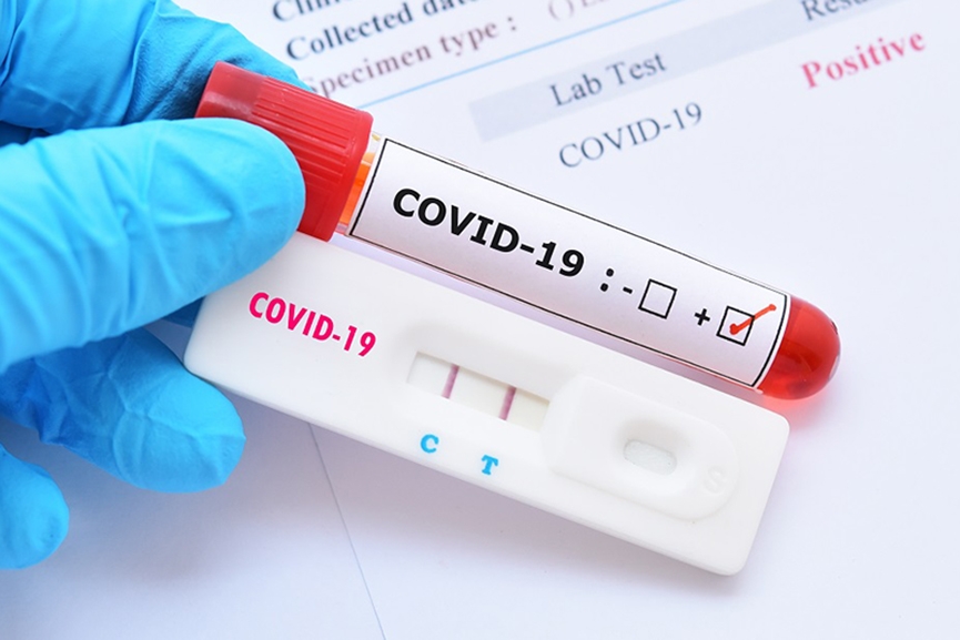 Recorde negativo: Gaspar tem mais de mil pessoas em isolamento com coronavírus