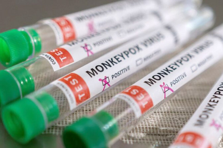 Gaspar tem tr�s casos suspeitos da var�ola dos macacos