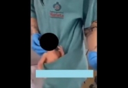 Beb� que estava no bolso de fisioterapeuta que dan�ou 'desenrola, bate, joga de ladinho' � prematuro