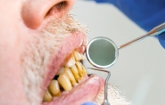 Sade bucal e doenas do corao:  entenda o risco de infarto e a sade dos seus dentes