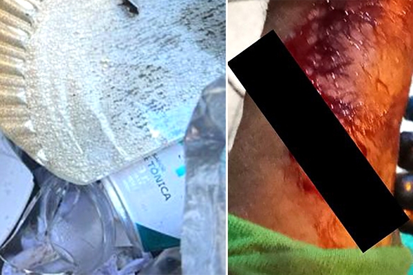 Cuidado no descarte de vidros pode evitar ferimentos em coletores, orienta Samae