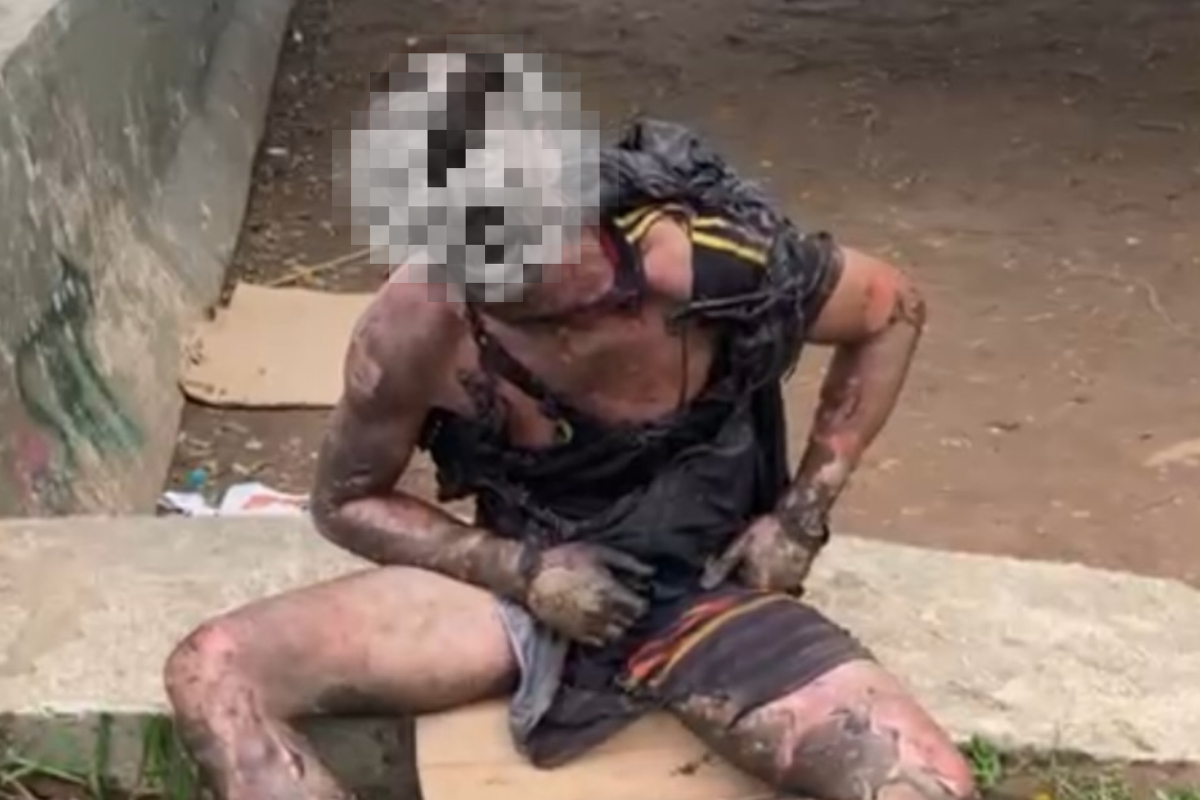 Homem sofre choque ao tentar furtar cabos de energia em Florianópolis