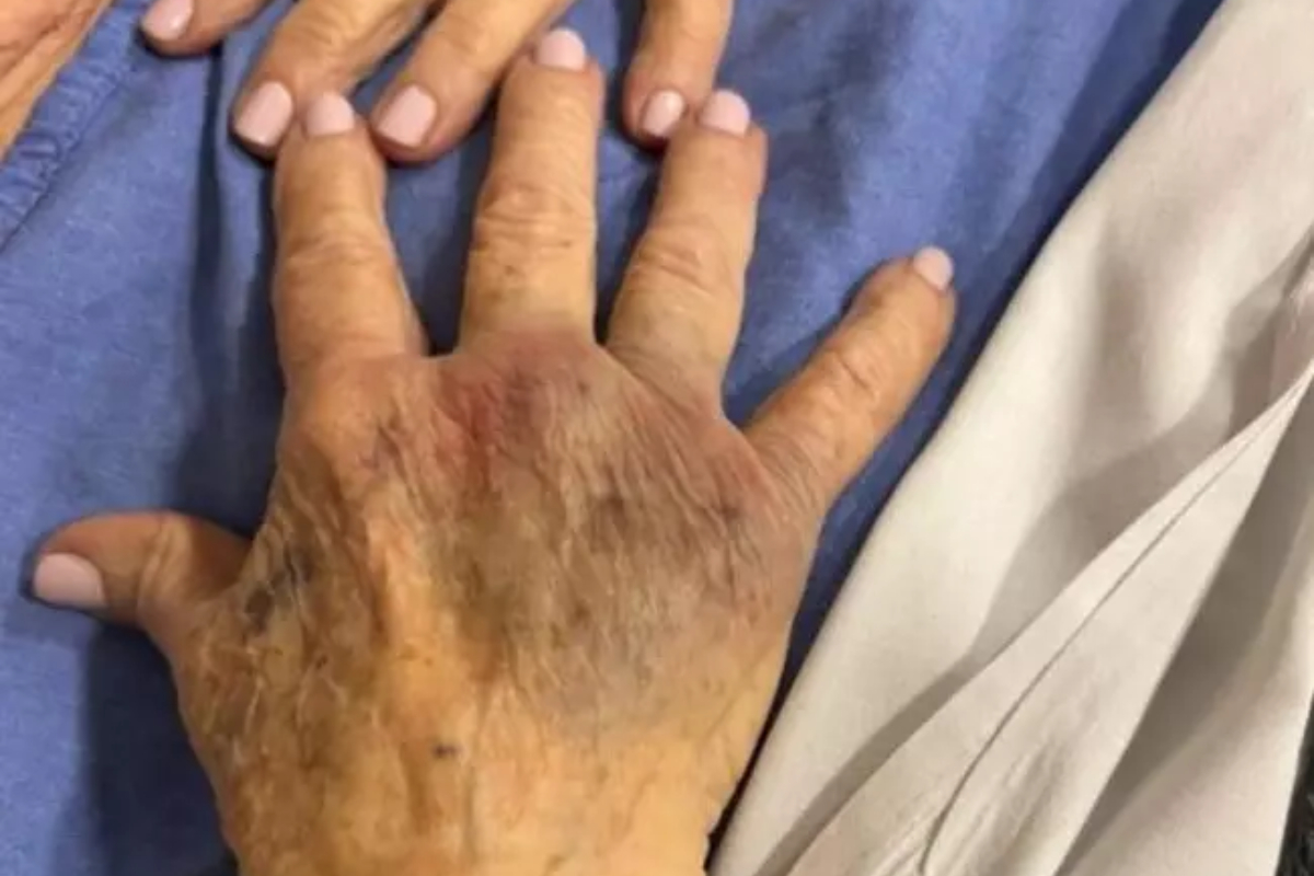 Filho espanca mãe idosa em Florianópolis após time perder partida de futebol